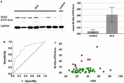 Reaction to Endoplasmic Reticulum Stress via ATF6 in Amyotrophic Lateral Sclerosis Deteriorates With Aging